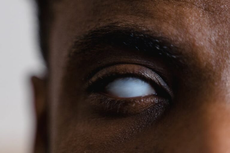 Charles Bonnet Syndrome: Understanding Visual Hallucinations & Vision Loss in California